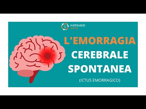 Video: L'emorragia intraventricolare scompare?