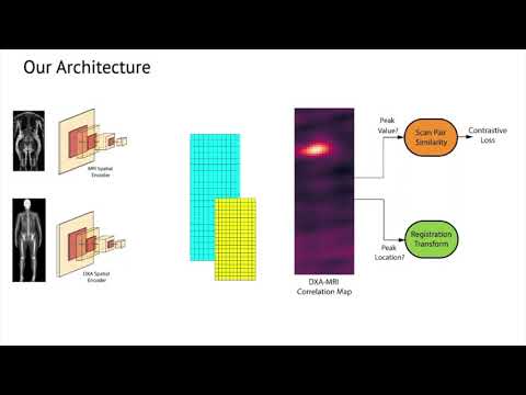 Self-Supervised Multi-Modal Alignment for Whole Body Medical Imaging (MICCAI 2021)