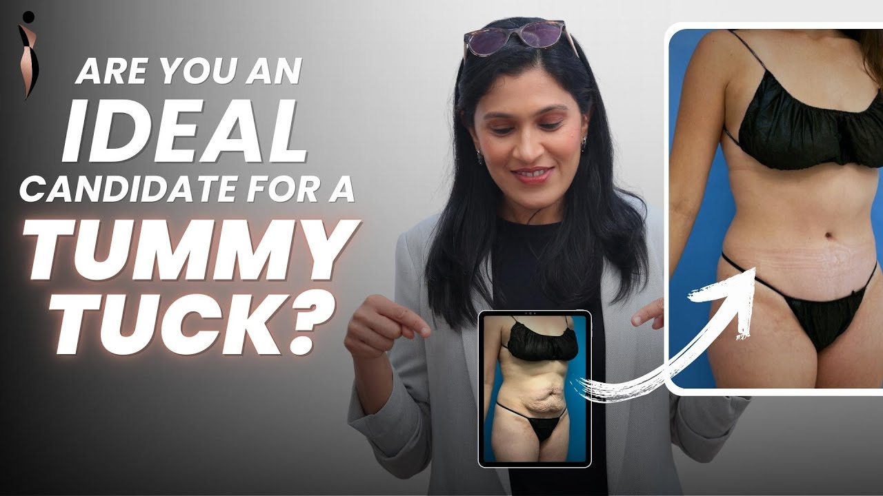 Tummy Tuck Surgery (Abdominoplasty): What it is & Who is the Right
