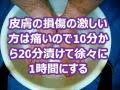 40年に亘る白癬菌との戦いに勝利 水虫完治法　香港腳完治法 JWHKGPS 312