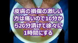 40年に亘る白癬菌との戦いに勝利 水虫完治法　香港腳完治法 JWHKGPS 312