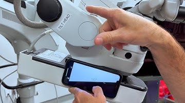 Surgical Ergonomics: Episode 3 The Scope | The Cataract Fellowship