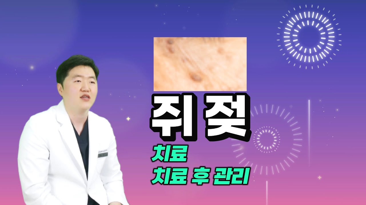 쥐젖 레이저 치료 후 관리도 중요합니다. 쥐젖제거하기 - YouTube