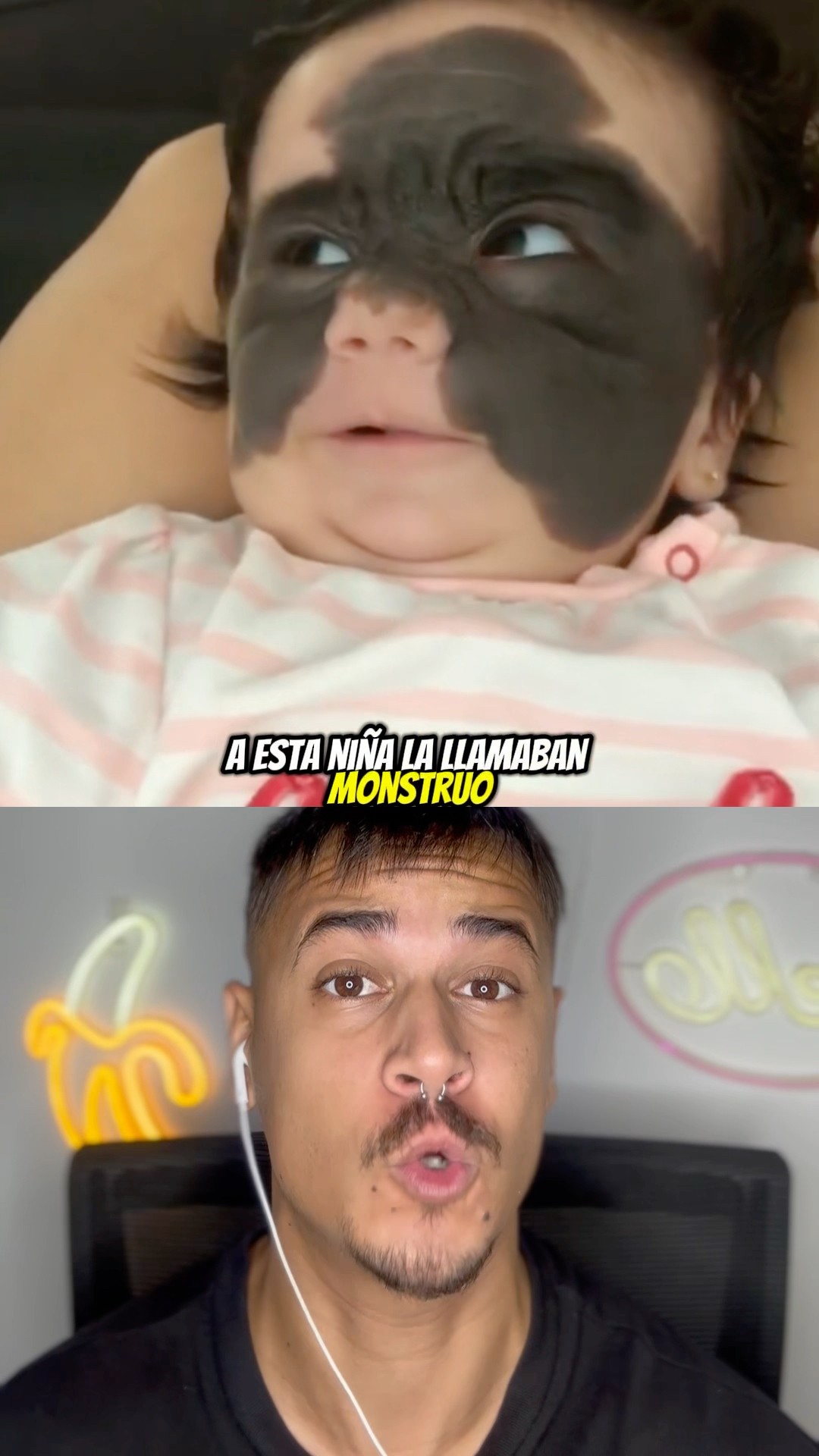 A Esta Niña La Llamaban Monstruo Pero Años Después Todos Alucinaron Con Su Cambio ? #shorts