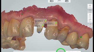TRIOS® - measures shades as you scan