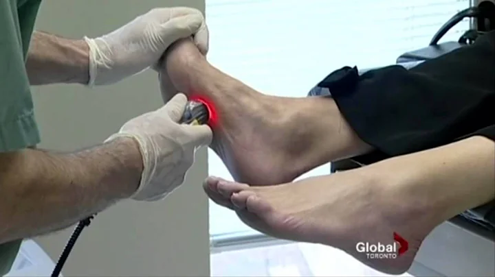 Podiatrist Toronto - Laser Pain Treatment for Foot Pain - Sheldon Nadal DPM