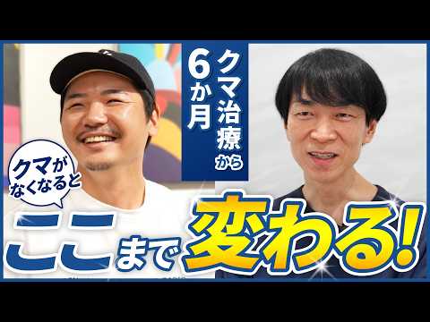 【クマ取り】6ヶ月後のリアルな変化｜クマがなくなるだけで若く見られる！？男性2名の術後に密着