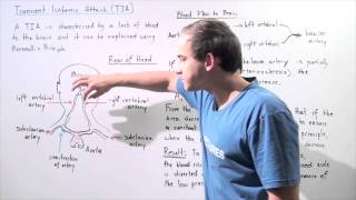 Transient Ischemic Attack and Bernoulli