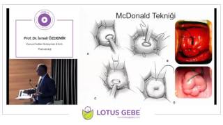 İSMAİL ÖZDEMİR - Servikal Abdominal Serklaj