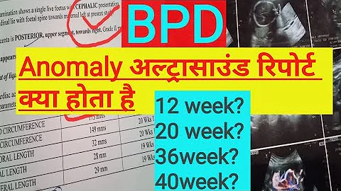 what is BPD in pregnancy ultrasound/week by week measurements