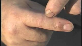 Reporting Workplace Injuries - Workers Compensation