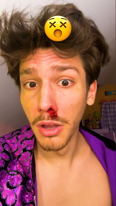 I got BEAT UP?! (Boxing Match 3) #shorts