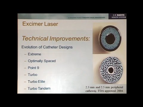 Video: Ar excimer fda patvirtinta?