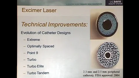 Atherectomy: Where Do We Stand after 12 Years Since FDA Clearance?