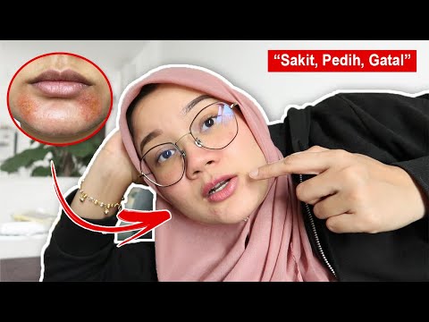 Video: Saya Mencuba Puasa Kulit, Trend Terkini Untuk Kulit Jernih