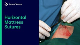 Horizontal Mattress Sutures