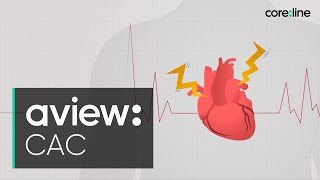 [KOR] AVIEW CAC Introduction