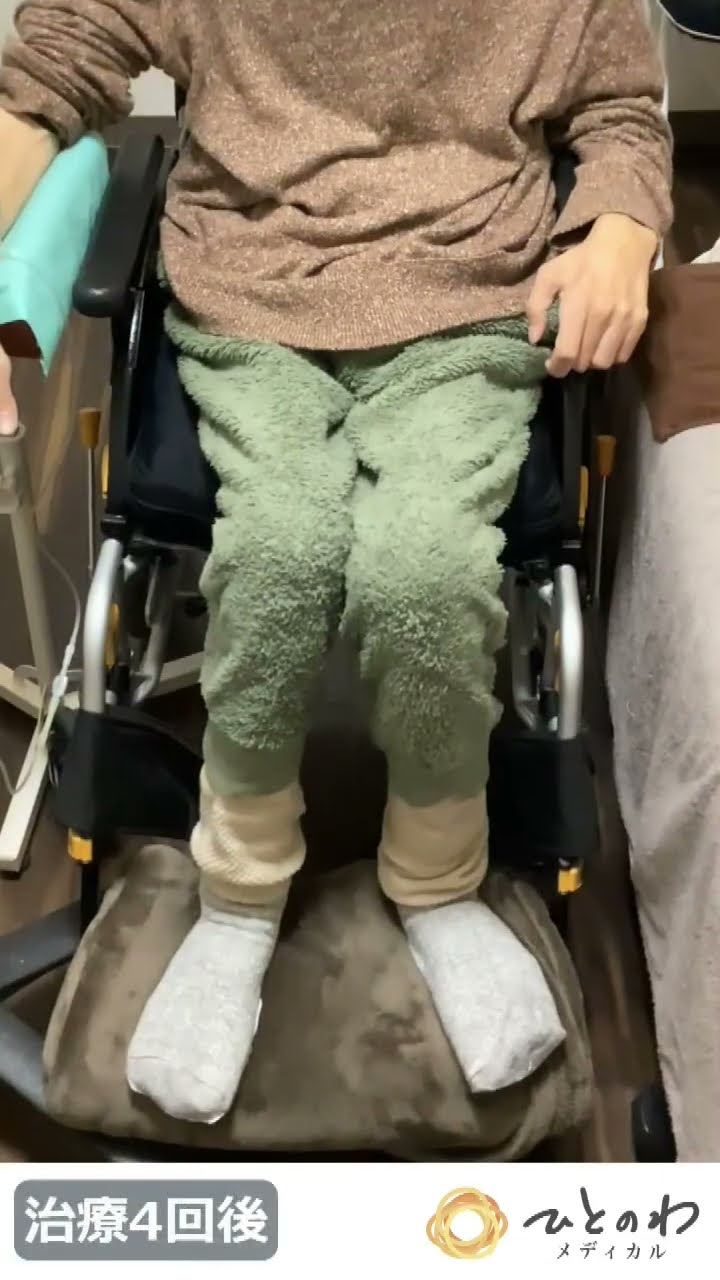 40代男性｜ALSの症例を紹介する動画のサムネイル画像