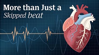Cardiac Arrhythmias: The Heart's Secret Life