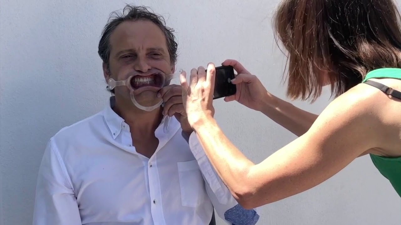 Protocole photos orthodontie maison