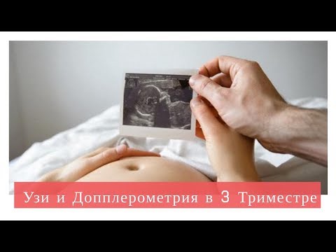 Допплерометрия в 3 Триместре | УЗИ Доплера при Беременности