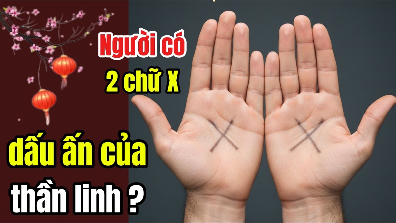 Người có 2 chữ X ở tay Trực giác siêu phàm hay là dấu ấn của thần linh
