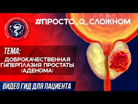 #ПРОСТО_о_СЛОЖНОМ Доброкачественная гиперплазия простаты (аденома)