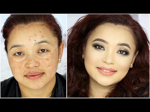 Makeup transformation for Hyper-Pigmentation / Acne Spots / Melasma