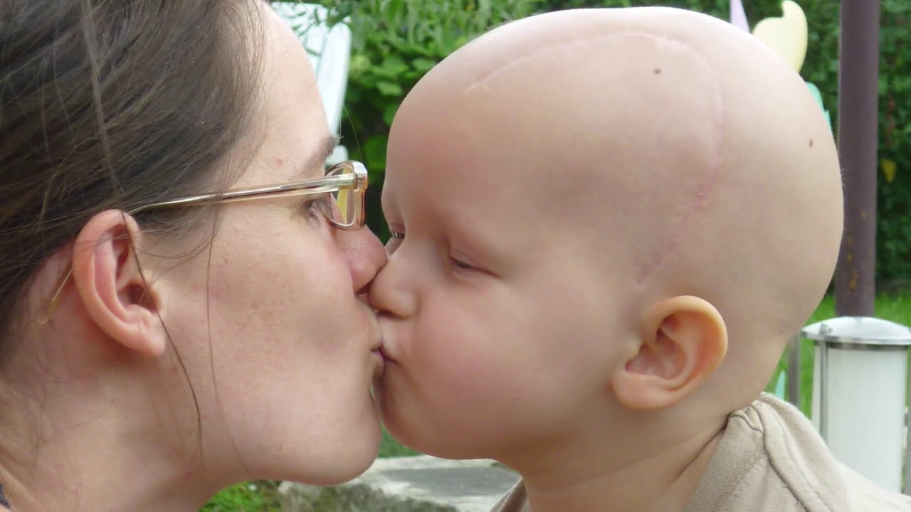 Krebs bei Kindern | Hannas Geschichte (Sonnenstrahl e. V. Dresden)