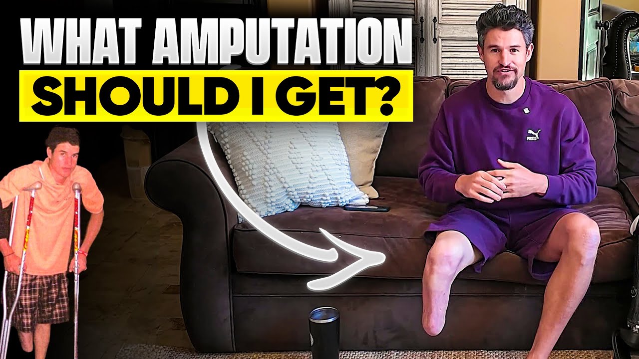 BEST type of AMPUTATION