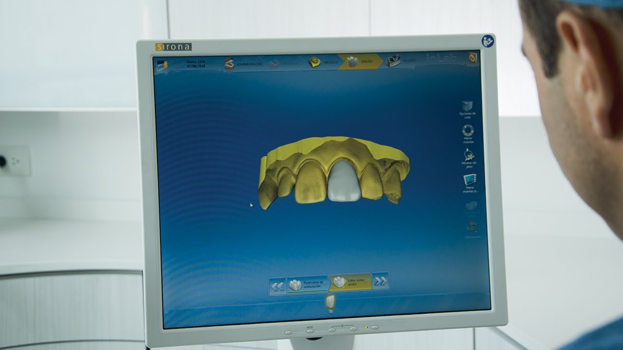 CEREC PREMIUM - YouTube