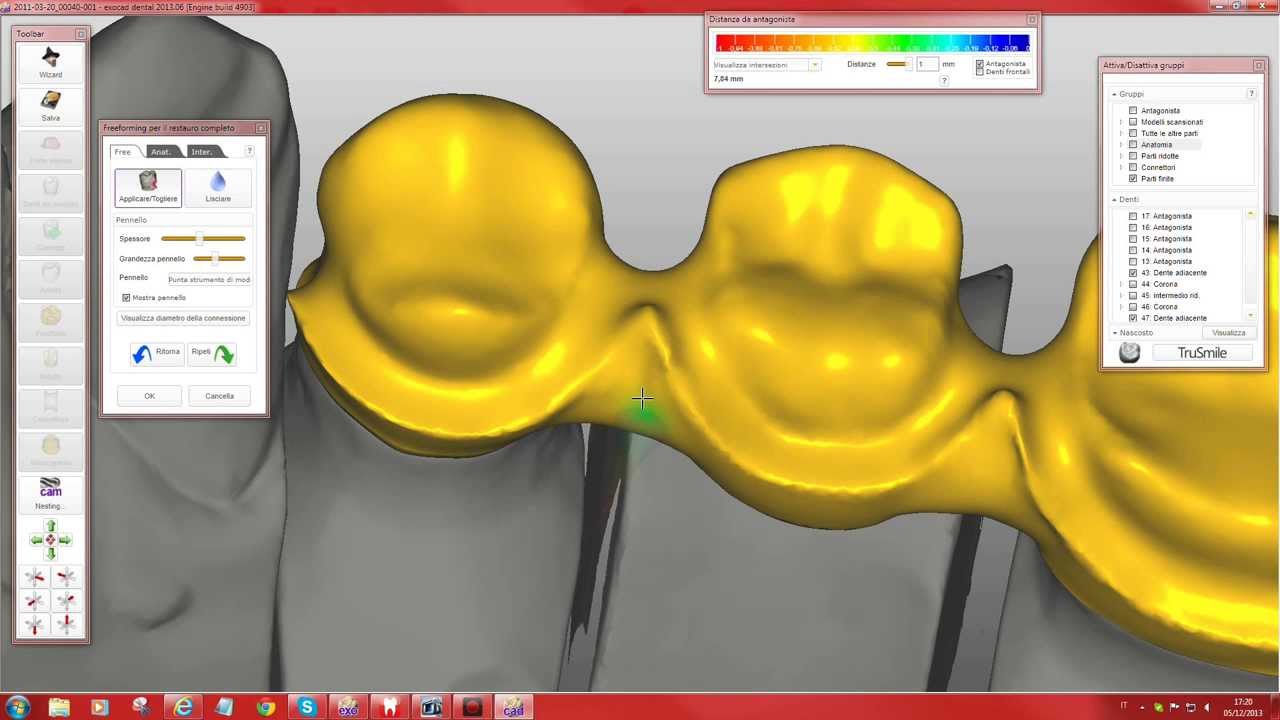 PROGETTO CAD IN 15 MINUTI (exoCAD)