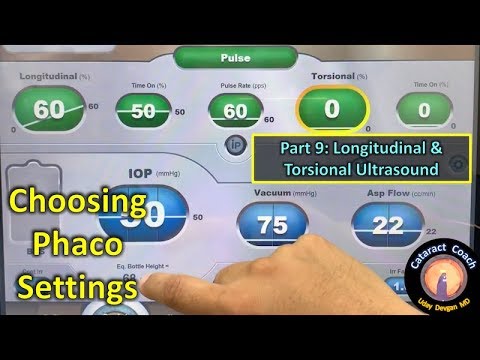 phaco fundamentals part 9: mixing longitudinal with torsional ultrasound power for cataract surgery