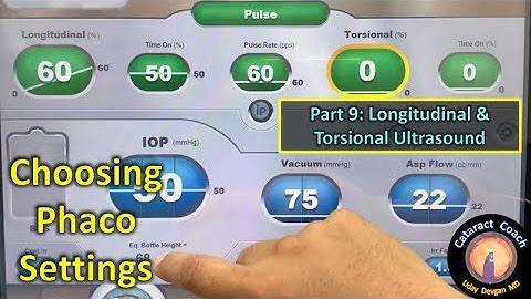 phaco fundamentals part 9: mixing longitudinal with torsional ultrasound power for cataract surgery