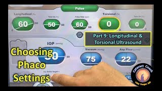 phaco fundamentals part 9: mixing longitudinal with torsional ultrasound power for cataract surgery
