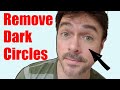 How to Reduce Dark Circles & Eye Bags + Truth About Eye Creams | Chris Gibson