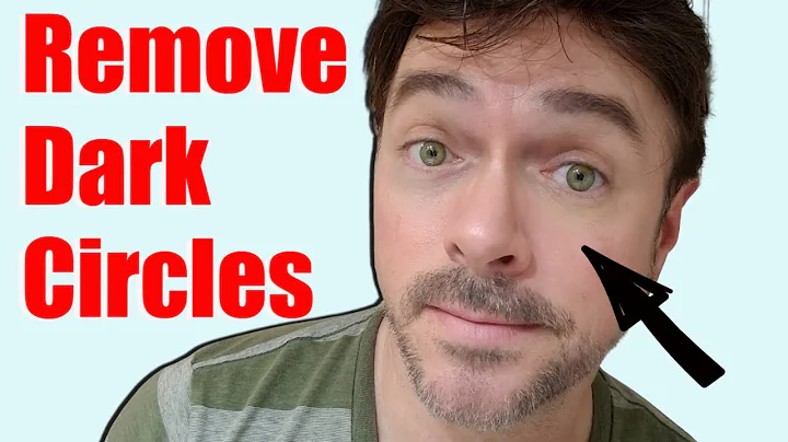 How to Reduce Dark Circles & Eye Bags + Truth About Eye Creams | Chris Gibson