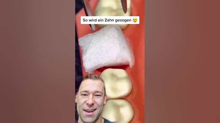 Zahn ziehen! #shorts