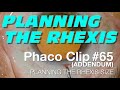Phaco clip 65 addendum  planning the rhexis size