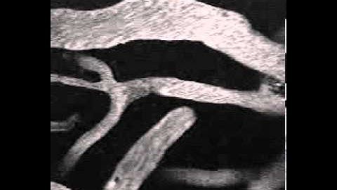 Localized Clot Formation