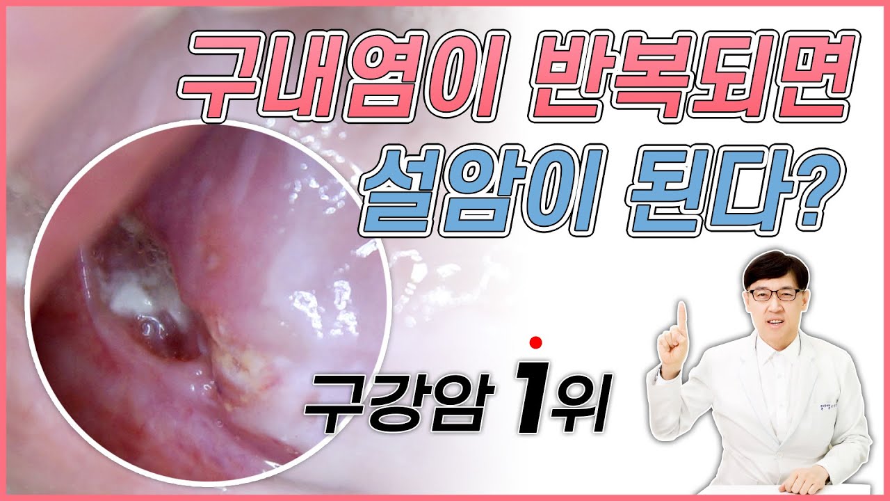 설암은 어디에 많이 생길까? 설암 사진으로 초기 증상 알아봐요 - YouTube