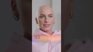 CHLOE BEAN ON BORN DIFFERENT? alopecia borndifferent bald alopeciaawareness hairloss viral