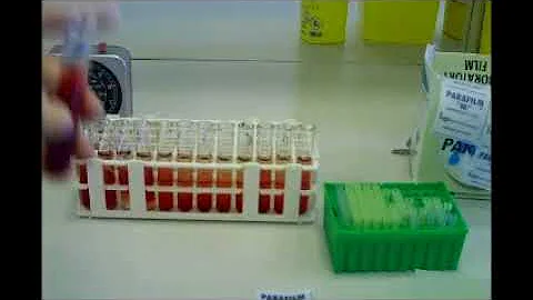 O que é o teste de fragilidade osmótica?
