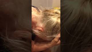 The Excruciating Pain Of A Cluster Headache Attack. With Kind Permission Of Karen Devlin Austin.