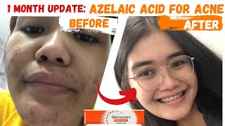 SKINOREN CREAM REVIEW - AZELAIC ACID