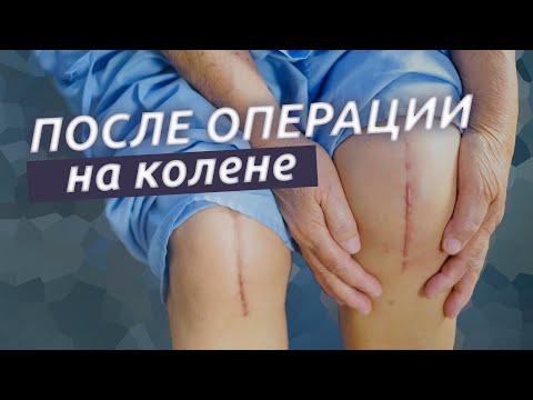 После операции на колене. Первые 2 недели.