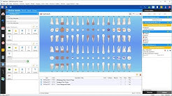 Abeldent Dental software, free download