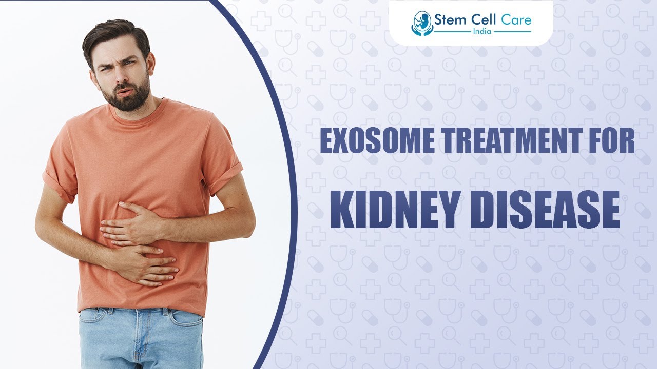 Exosome Therapy for Kidney Disease | A New Hope in Regenerative Medicine |