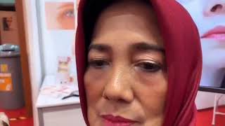 Vitayes Instant Ageback Live Demo 3