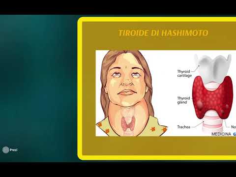 Video: Trattamento Delle Malattie Autoimmuni: Metodi Efficaci E Moderni